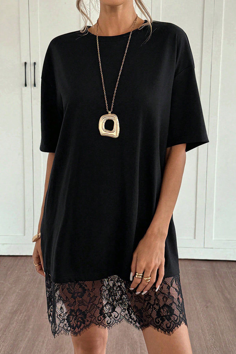 Lace Hem Casual Dress